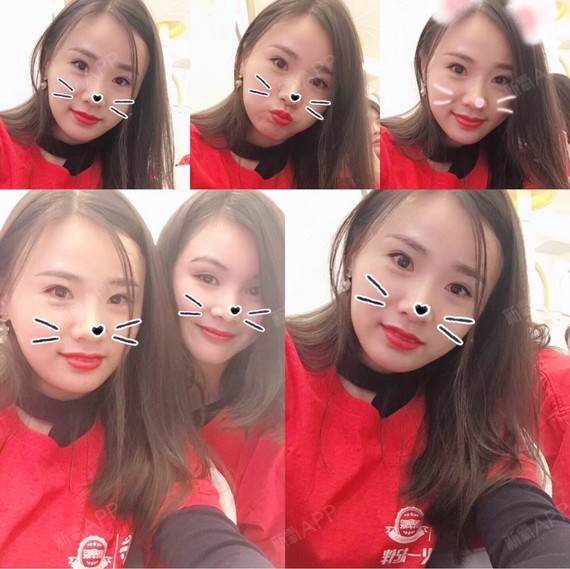 北京眼部修复好不好_效果图_大美涵眼部修复术后第396天_新氧美容整形