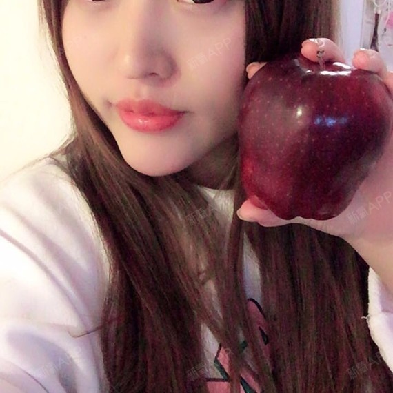 玻尿酸打嘟嘟唇!第二天!不满意不满意!