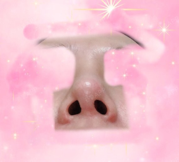 鼻头歪的问题我去医院复查了n次了,鼻小柱是肯定歪了_圈子-新氧美容