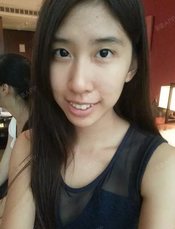 我的牙齿虎牙比较突出,有点覆合,从小就被说牙不好看,也不敢随便笑