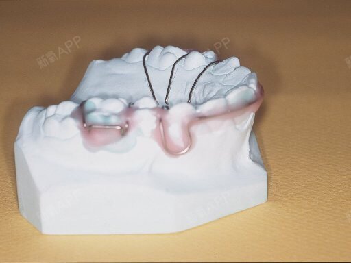 医生的手工活之唇弓的弯制唇弓是活动矫治器上位于牙弓_圈子-新氧美容