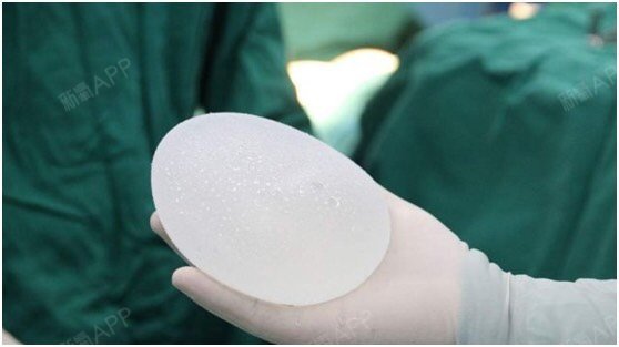 乳房假体是一种通过手术植入_圈子-新氧美容整形