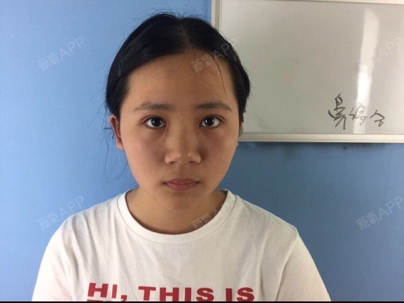 做了鼻子老公说我年轻了十岁