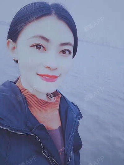 隆鼻教科书整容史让你路人变女神项目:膨体综合隆鼻医院:武汉一美_圈子-新氧美容整形