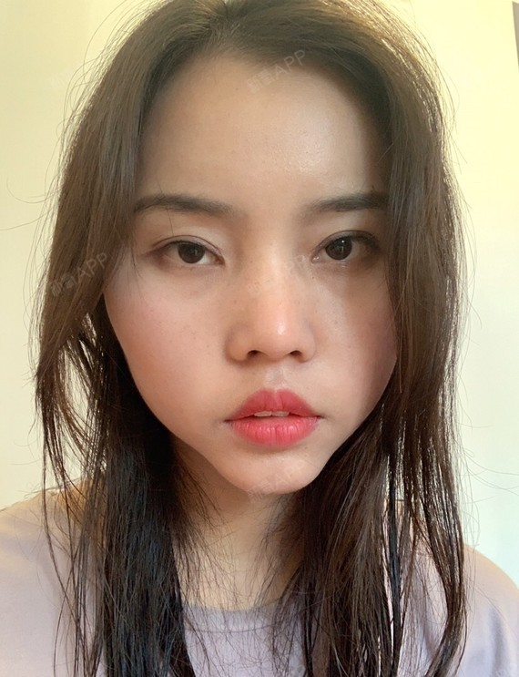 夏娃娃008上颚前突/天包地第30天美丽日记