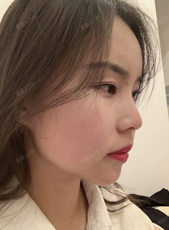 今天给大家拍了侧脸,以前拍照都不敢拍侧脸的,但现