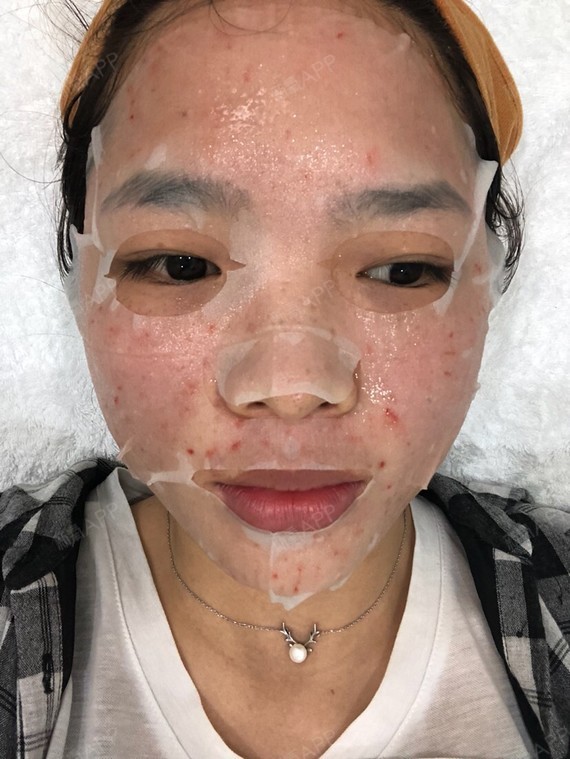 serena_1217果酸焕肤第0天美丽日记