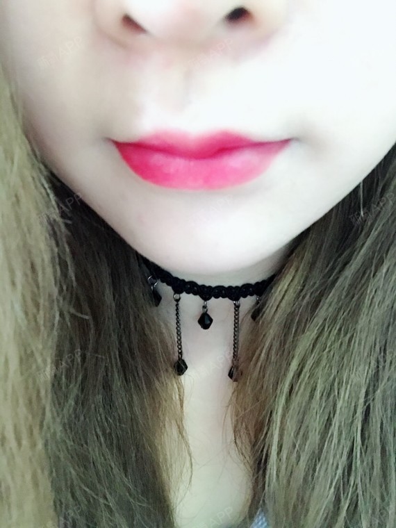 打了唇珠,下唇两边共三针,量刚刚好,一点都没有肿,_圈子-新氧美容整形