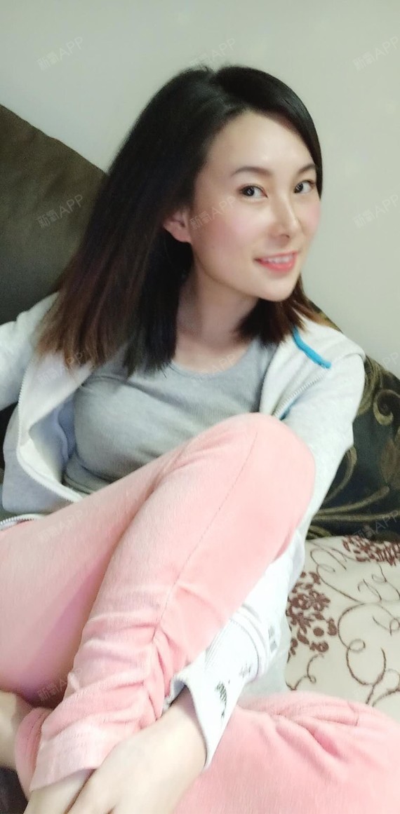 自体脂肪全脸填充好不好_效果图_氧气xsi975c自体脂肪全脸填充术后第