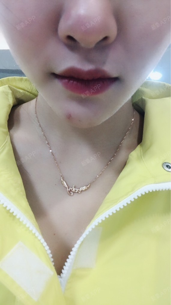溶解酶