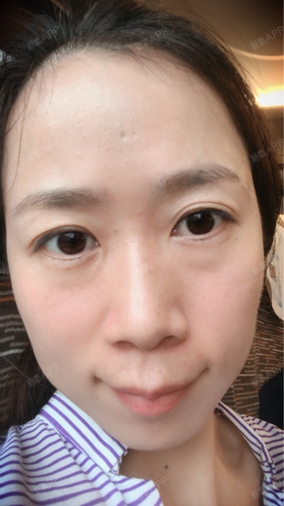 第十天已经达到这样的效果,本小主真真满意. 自己持