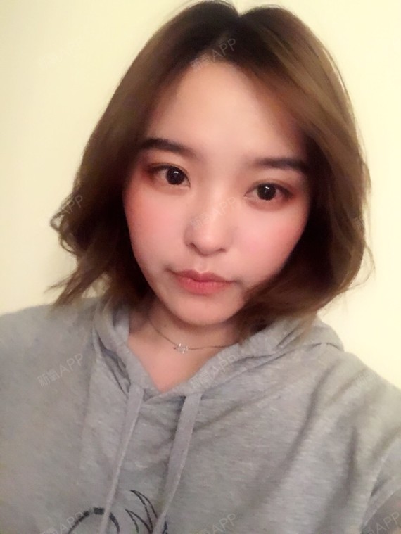 拍照给大家看一下侧脸鼻子的样子,医生有说,心形脸配_圈子-新氧美容