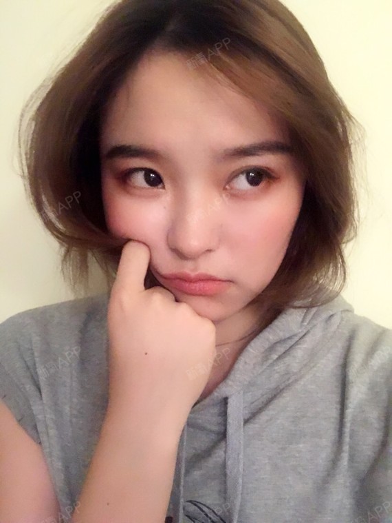 拍照给大家看一下侧脸鼻子的样子,医生有说,心形脸配_圈子-新氧美容