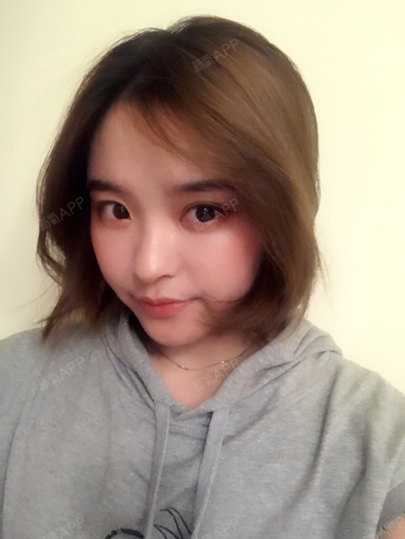 拍照给大家看一下侧脸鼻子的样子,医生有说,心形脸配_圈子-新氧美容