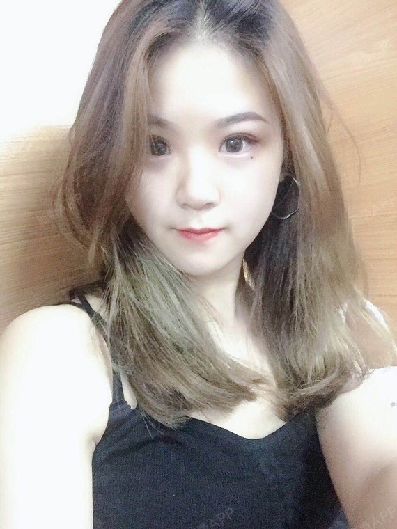 重庆切开双眼皮好不好_效果图_小周周23切开双眼皮术后第57天_新氧