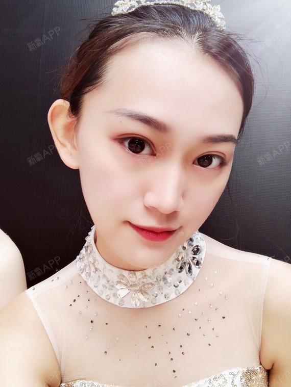 我问了蛮多医生朋友的,_圈子-新氧美容整形