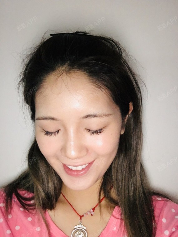 感觉恢复的差不多了画了鼻影之后鼻子看着更立体了草鸡_圈子-新氧美容