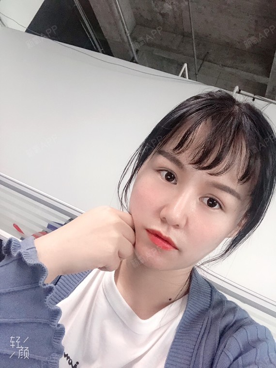 那边的南方不在那边伊肤泉微针术后第17天美丽日记_新氧整形