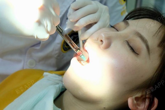 一直想做隐形牙齿打麻药睡着的人根管治疗打麻药美容打的麻药叫什么