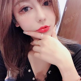 广州艺美医疗美容门诊部李闯医生怎么样_好不好_挂号_整形案例-新氧