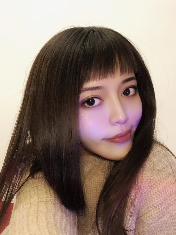 这是注射完瘦脸针的第六天,已经感觉咬肌部分明显变小_圈子-新氧美容