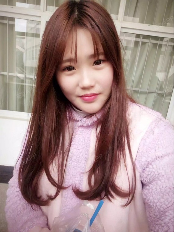 注射瘦脸好不好_效果图_hhhhhjj注射瘦脸术后第90天_新氧美容整形