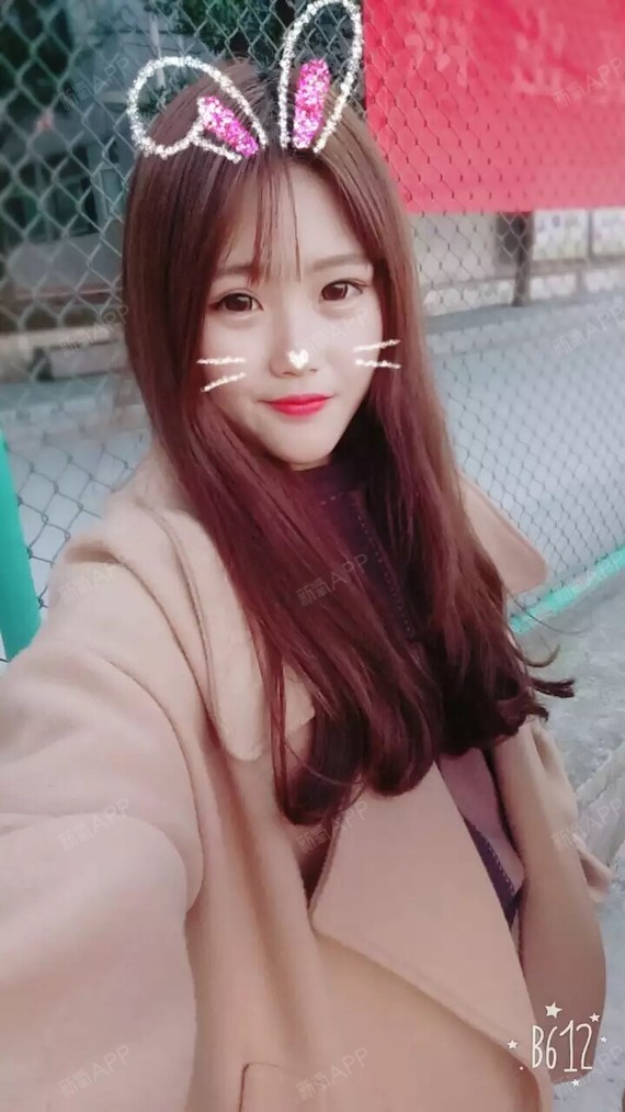 兰州注射瘦脸好不好_效果图_hhhhhjj注射瘦脸术后第90天_新氧美容整形