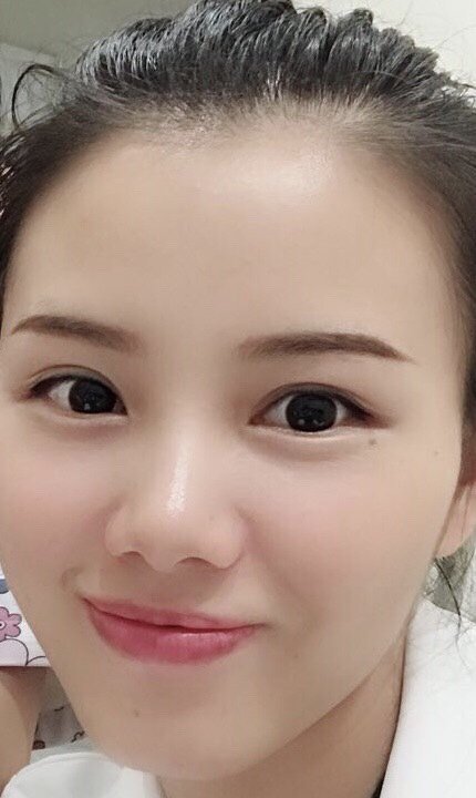 半永久美瞳线第30天