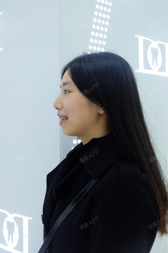 拍个侧面,下次好做对比