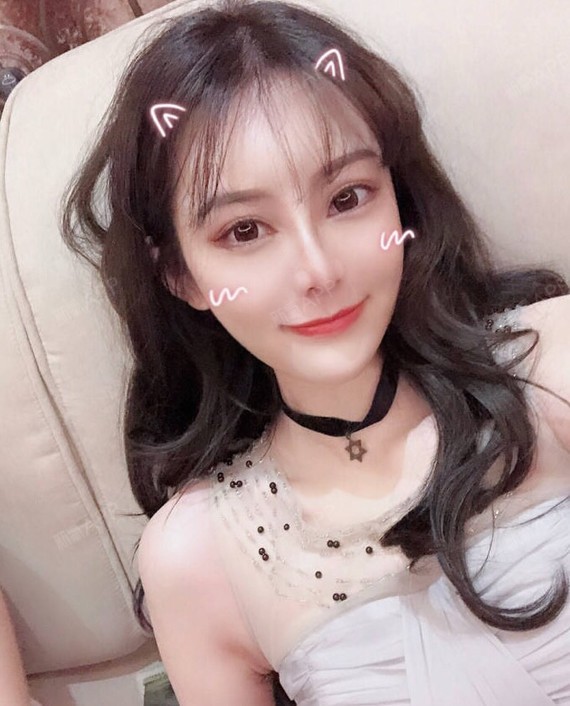 北京耳软骨复合隆鼻好不好_效果图_妮可基德曼1耳软骨复合隆鼻术后第