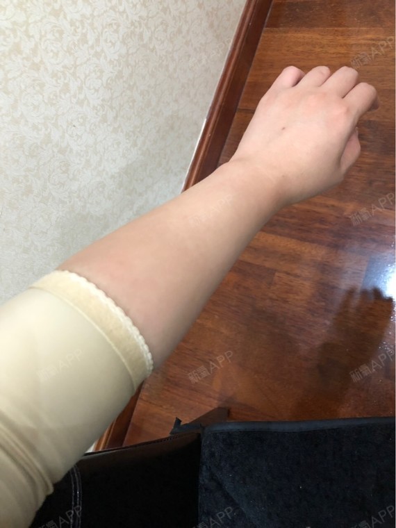 今天左手的下手臂有点肿,可能是昨天吃了个辣鸡爪的缘_圈子-新氧美容