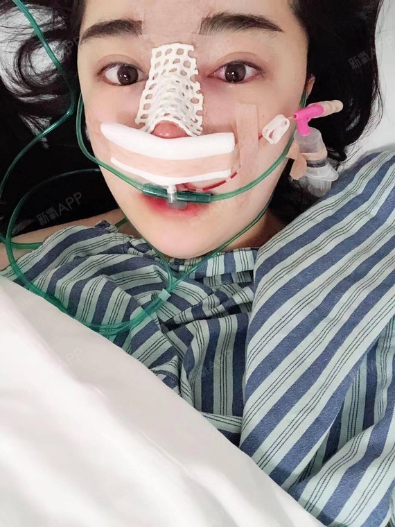 第一次来新氧发日记,不知道能不能成功申请到返现啊,_圈子-新氧美容