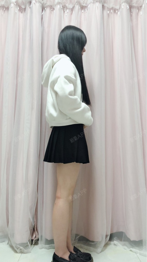 美爆胎的仙女儿吸脂瘦小腿第15天美丽日记