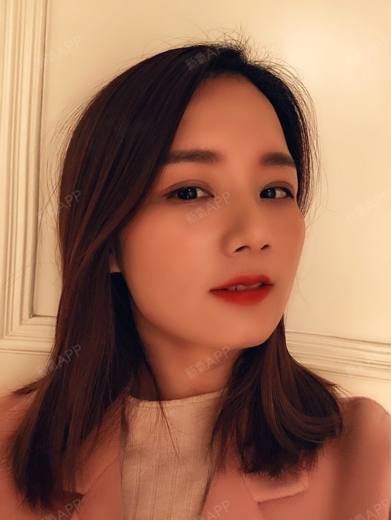 切开双眼皮好不好_效果图_懒兔兔兔兔切开双眼皮术后第368天_新氧美容