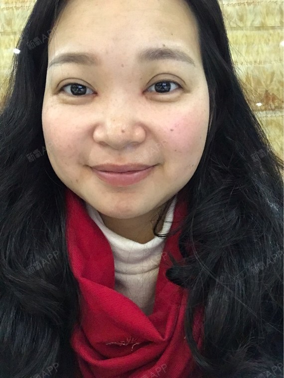 好宽好宽左右不一眼角还好红停了两天没擦疤克