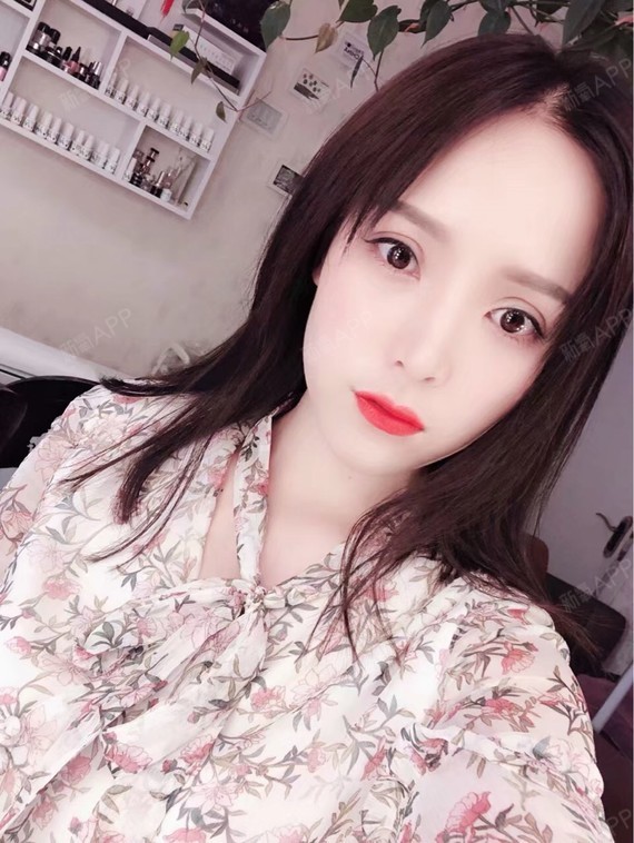 发几张术后双眼皮美炸了的照片