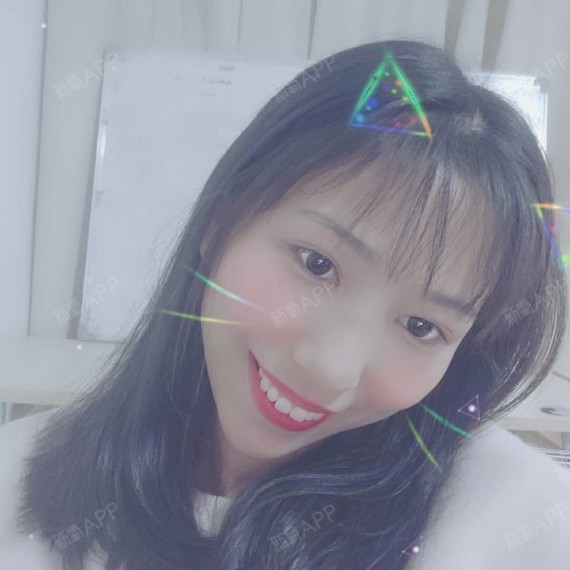 阳光女郎肉毒素瘦脸第12天美丽日记-新氧美容整形