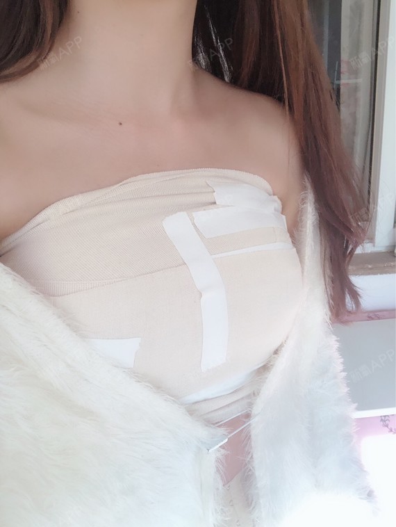 童话世界里都是骗人的假体隆胸第4天美丽日记