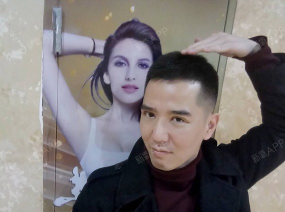 林少就是林东开内眼角第8天美丽日记-新氧美容