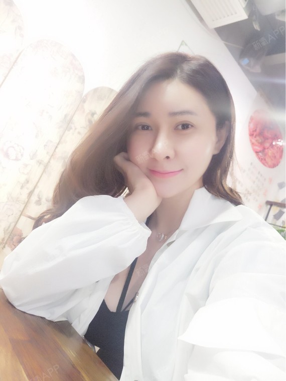 转眼术后一个月了,最明显的是全脸字体脂肪填充已经很_圈子-新氧美容