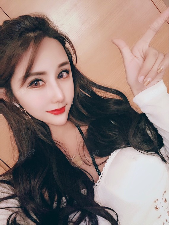 好不好_效果图_娜依灵儿本尊颧骨颧弓整形术术后第668天_新氧美容整形