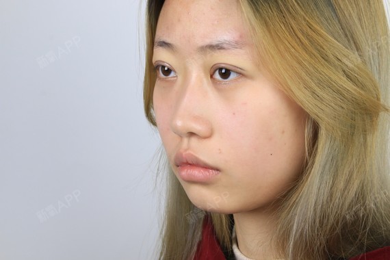 双眼无神略显呆滞?