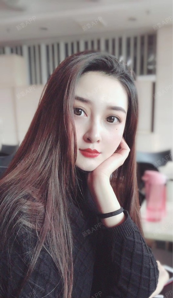 童颜针好不好_效果图_岳岳bar童颜针术后第66天_新氧美容整形