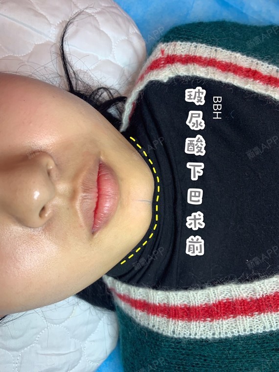 正面看起来下巴中间有一个小凹槽并且左右两边下巴的高低不一样