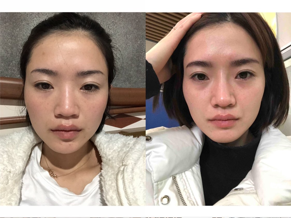 看看巫文云的真实案例