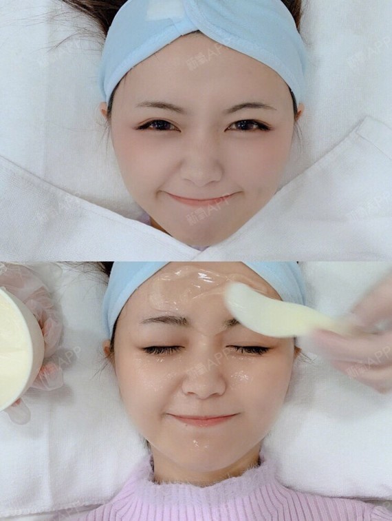 无针水光,其实就是将原液,通过仪器导入你的皮肤,达_圈子-新氧美容