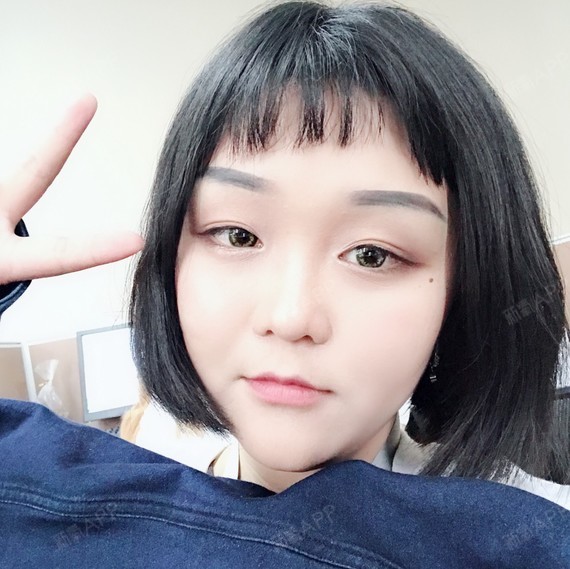 激光祛斑好不好_效果图_辘辘mai激光祛斑术后