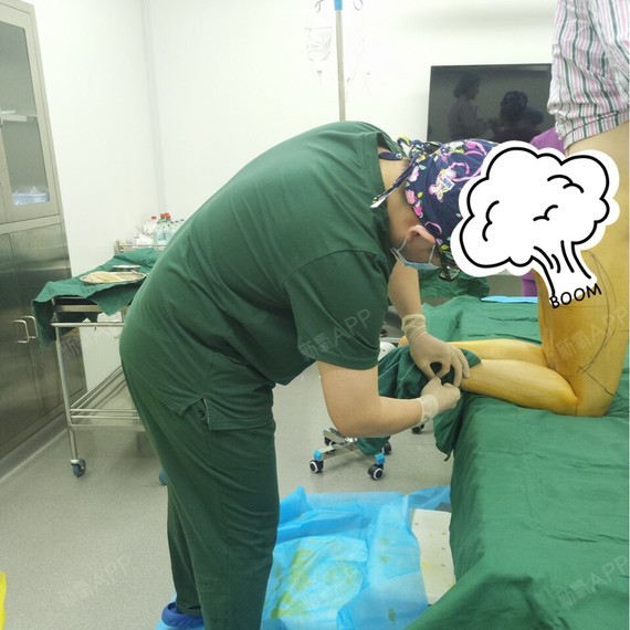 我是3月3号下午做的吸脂.