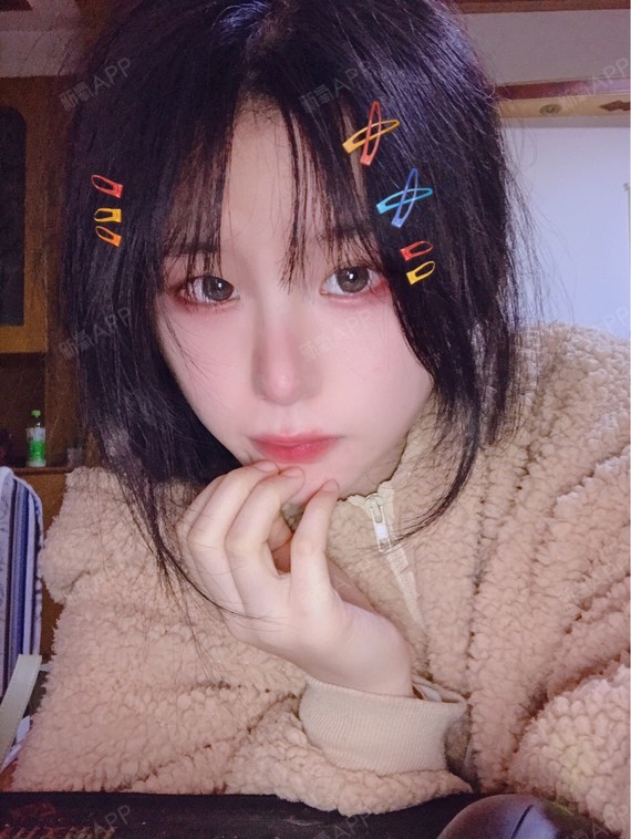 1个小泡泡手术缩鼻头第80天美丽日记-新氧美容