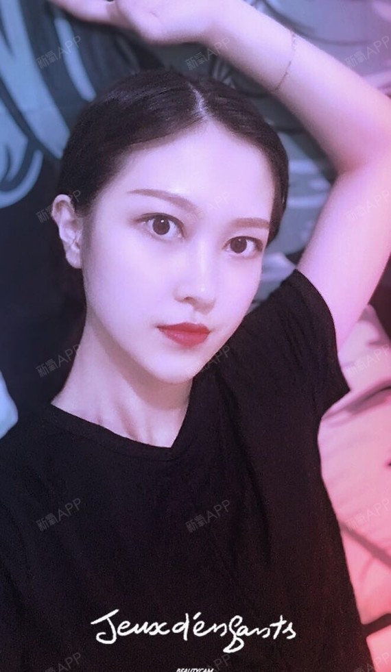 脸部填充线雕_全脸填充加线雕恢复的多长时间_脸部填充好还是线雕好